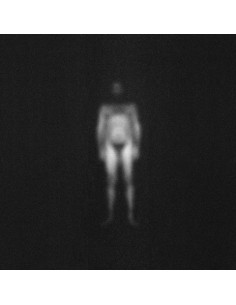 Iosonouncane - Ira - Colored Vinyl 2