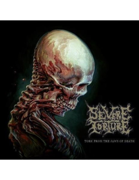 Severe Torture - Torn From The Jaws Of Death