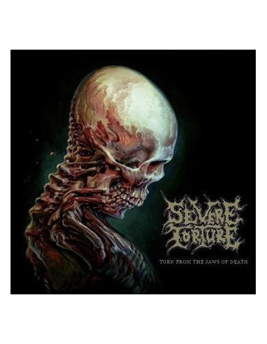 Severe Torture - Torn From The Jaws...