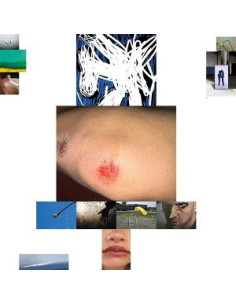 Helfenstein, Remo - Spite